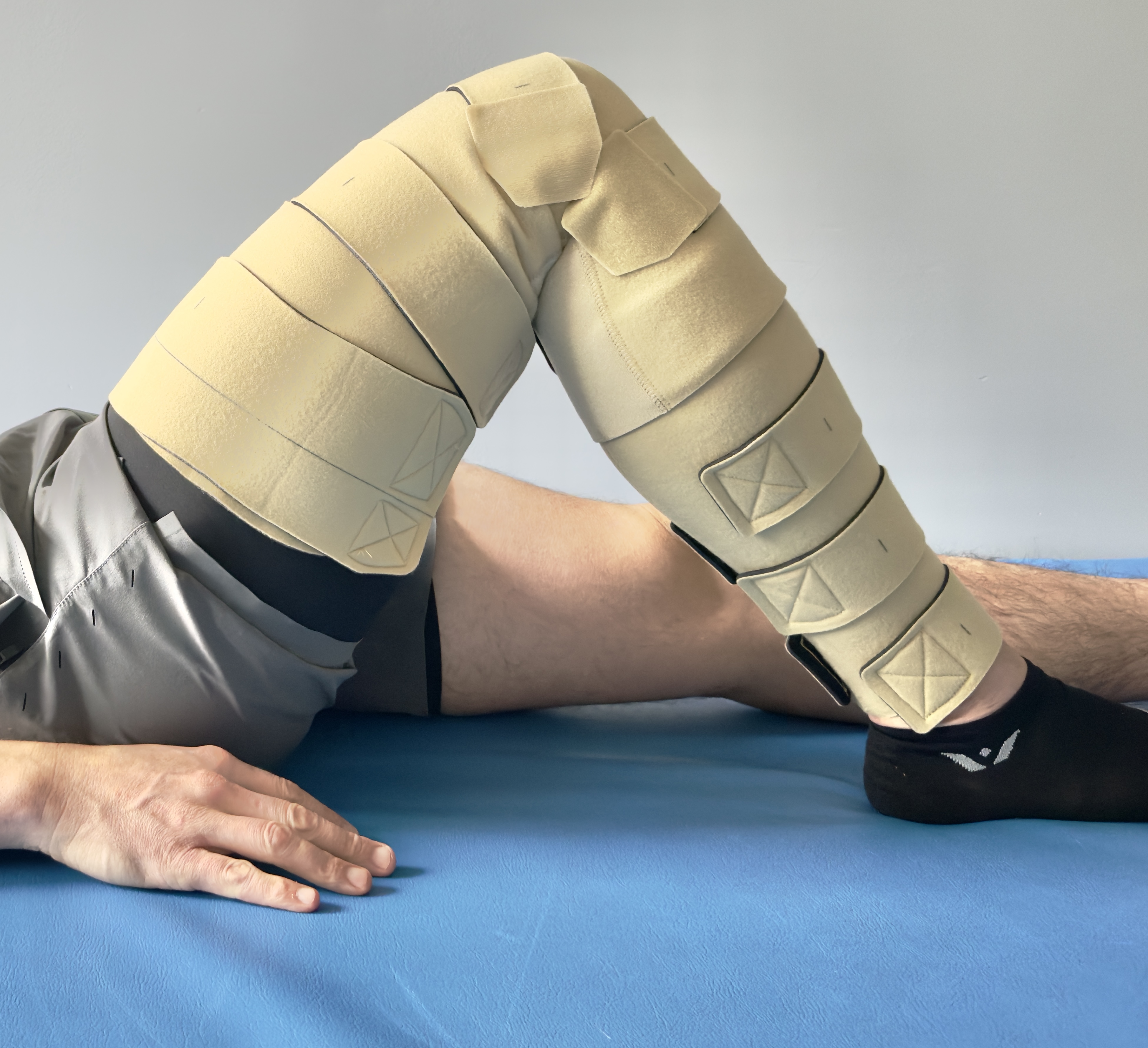 Photo of a man's leg in a cast.