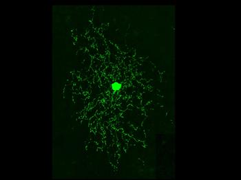 Person figure 1 -- Golgi Cell Fill