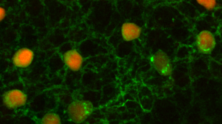 Expressomics and transcriptomics Expressomics and transcriptomics