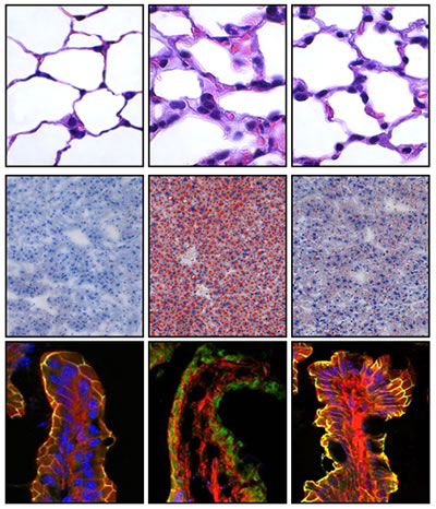 Gut Liver Lung -- 400 x 466