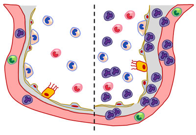 Lung Drawing