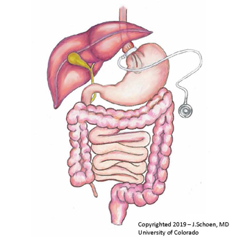 Gastric Band Gastric Band