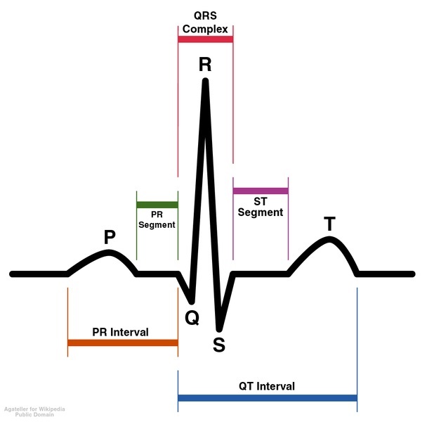 Schematic diagram of normal sinus rhythm for a human heart as seen on Electrocardiogram