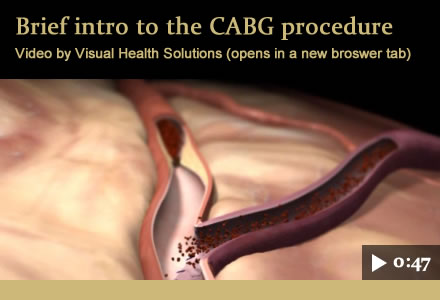 Video: Brief intro to the CABG procedure