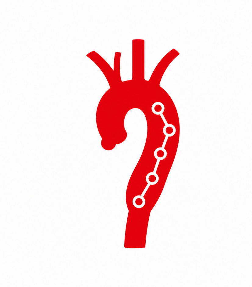 Genetically Triggered Aortopathy