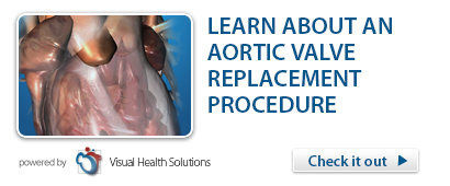 Video -- Aortic Valve Replacement