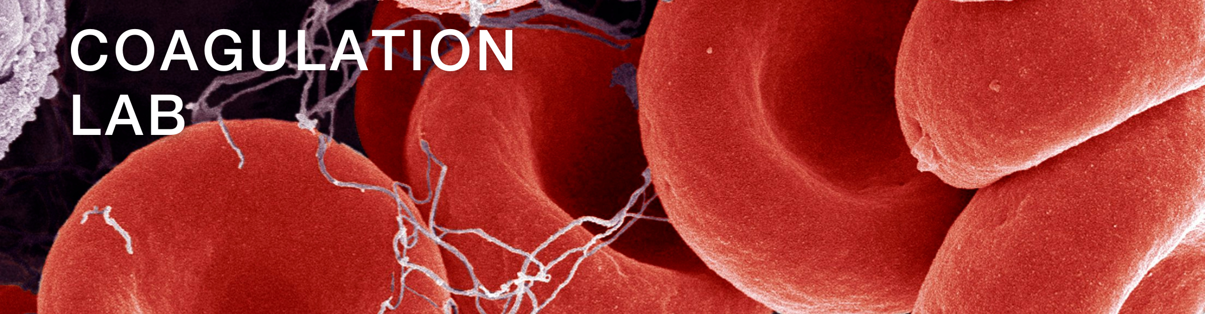 Coagulation Banner