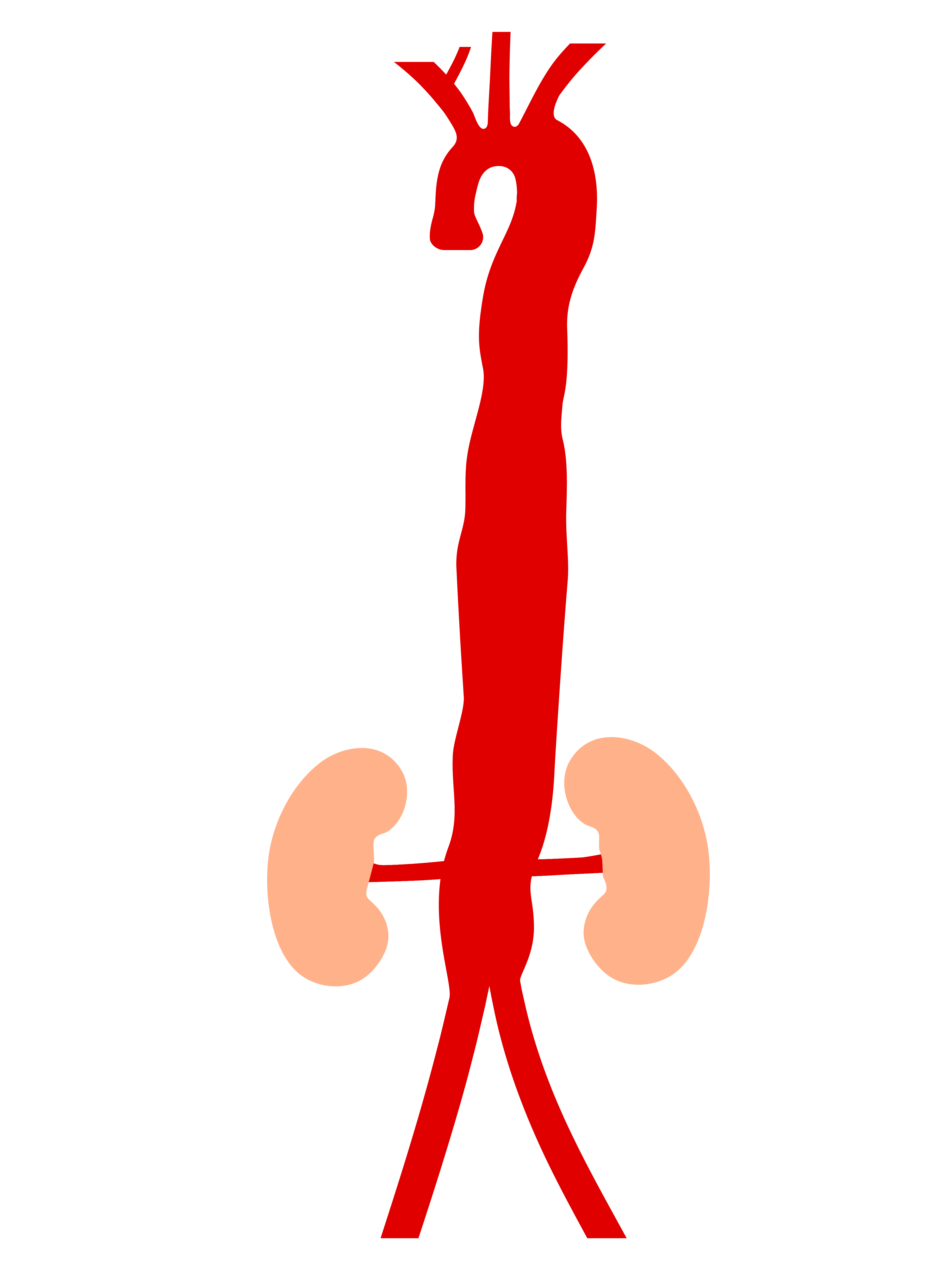 Aneurysm2