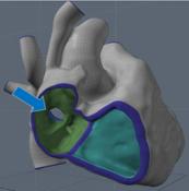3D_Imaging - 2
