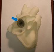 3D_Imaging - 3