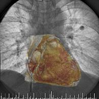 3D_Imaging - 4