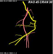 3D_Imaging - 7