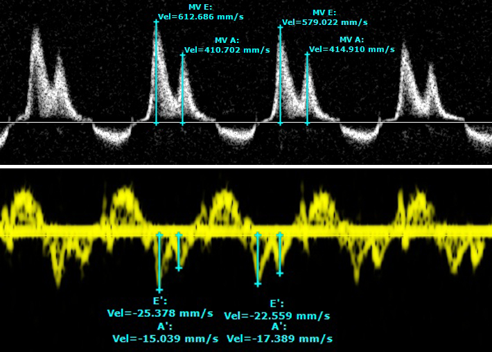 Imaging - 2 Imaging - 2