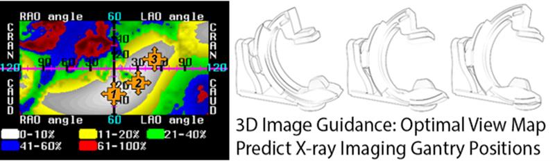 PCI-Optimal-View PCI-Optimal-View