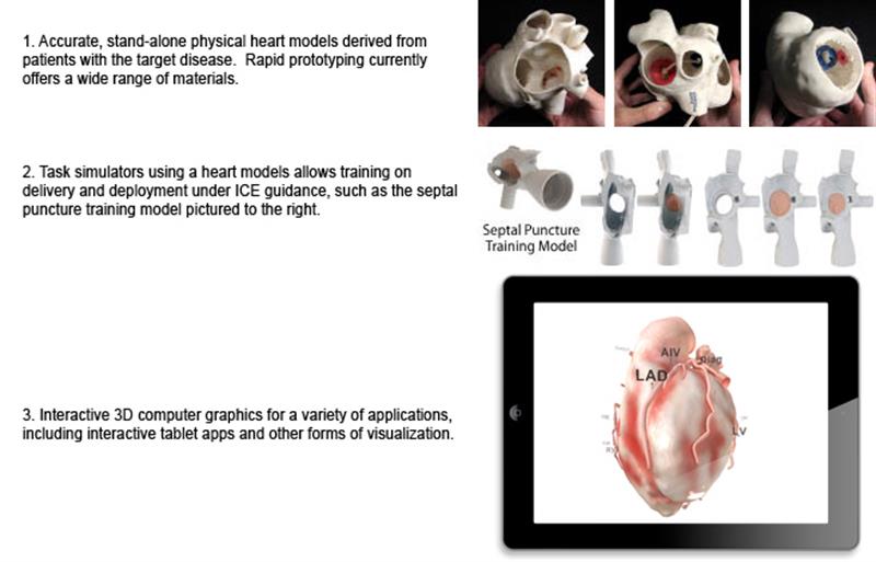 Structural_Heart - 2 Structural_Heart - 2