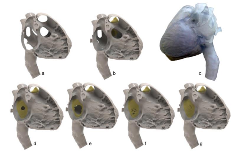 Structural_Heart - 4 Structural_Heart - 4