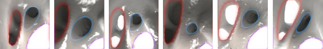 Structural_Heart - 6.1