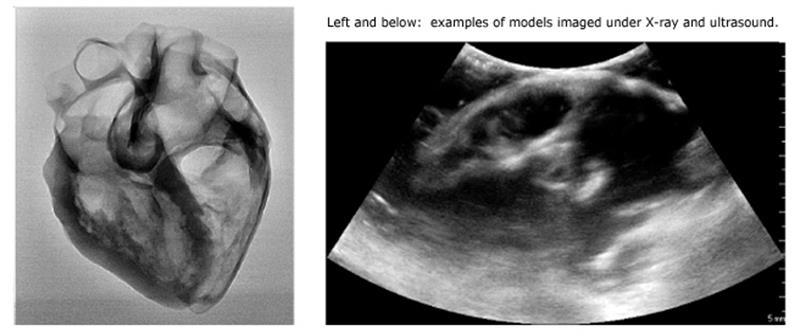 Structural_Heart - 7 Structural_Heart - 7