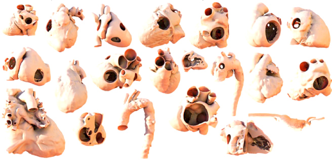 Structural_Heart - 8