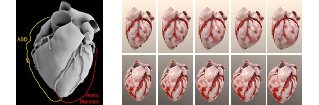 Structural_Heart - 9
