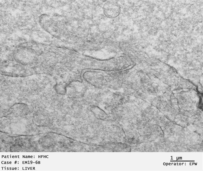Liver Tissue