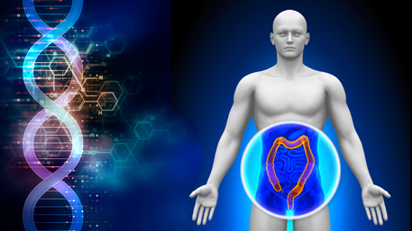2018-08_blog_colorectal_cancer 2018-08_blog_colorectal_cancer