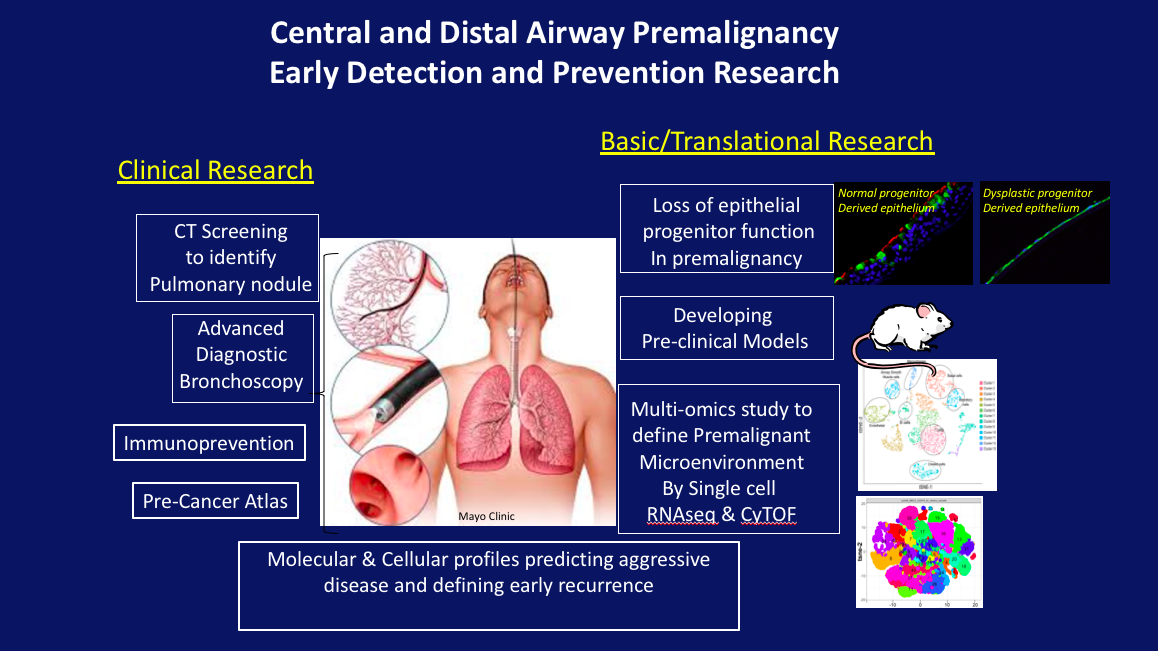 PULM-Malig Pulmonary Malignancy Program
