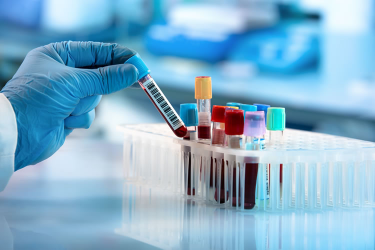 RNA Clinical Discovery (750 x 500)